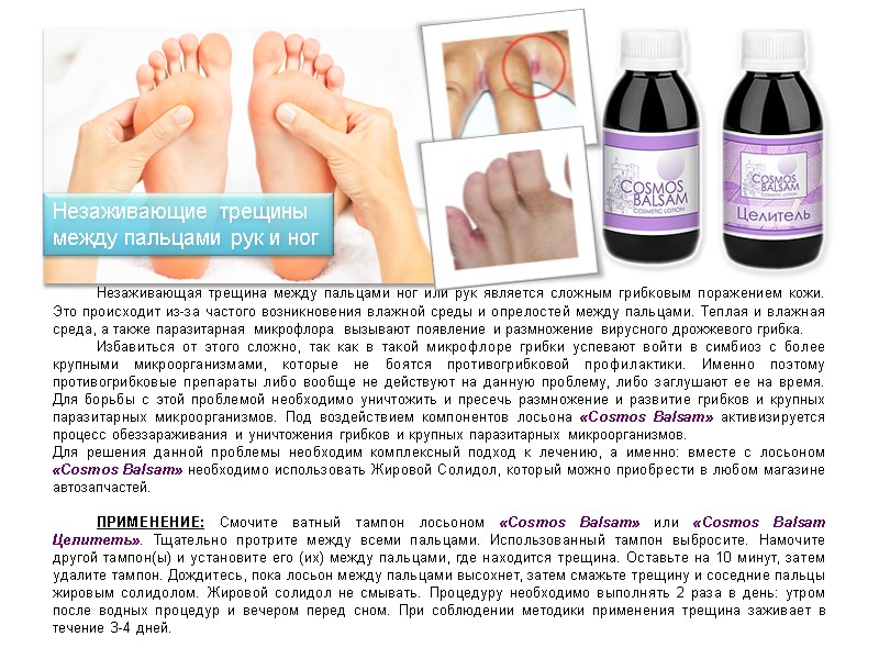 Незаживающая трещина между пальцами ног или рук является сложным грибковым поражением кожи. Это происходит